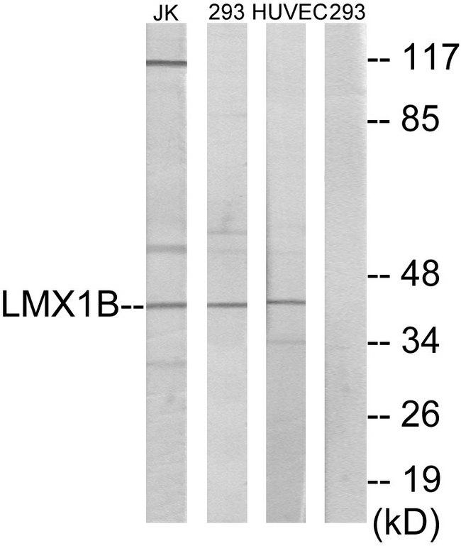 LMX1B Antibody - Western blot analysis of extracts from Jurkat cells, 293 cells and HUVEC cells, using LMX1B antibody.