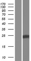 LNP1 Protein - Western validation with an anti-DDK antibody * L: Control HEK293 lysate R: Over-expression lysate