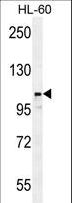 LNPEP Antibody - LNPEP Antibody western blot of HL-60 cell line lysates (35 ug/lane). The LNPEP antibody detected the LNPEP protein (arrow).