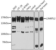 LNPEP Antibody - Western blot analysis of extracts of various cell lines, using LNPEP antibody at 1:3000 dilution. The secondary antibody used was an HRP Goat Anti-Rabbit IgG (H+L) at 1:10000 dilution. Lysates were loaded 25ug per lane and 3% nonfat dry milk in TBST was used for blocking. An ECL Kit was used for detection and the exposure time was 30s.