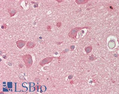 LNX1 / LNX Antibody - Human Brain, Cortex: Formalin-Fixed, Paraffin-Embedded (FFPE)