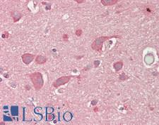 LNX1 / LNX Antibody - Human Brain, Cortex: Formalin-Fixed, Paraffin-Embedded (FFPE)
