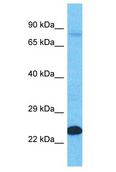 LNX2 Antibody - LNX2 antibody Western Blot of HT1080. Antibody dilution: 1 ug/ml.  This image was taken for the unconjugated form of this product. Other forms have not been tested.