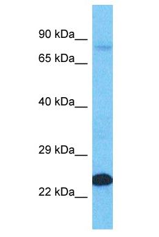 LNX2 Antibody - LNX2 antibody Western Blot of HT1080. Antibody dilution: 1 ug/ml.  This image was taken for the unconjugated form of this product. Other forms have not been tested.