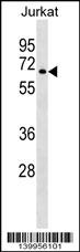LOC100996634 Antibody - YF005 Antibody (N-term) western blot analysis in Jurkat cell line lysates (35ug/lane).This demonstrates the YF005 antibody detected the YF005 protein (arrow).