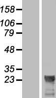 LOC285908 Protein - Western validation with an anti-DDK antibody * L: Control HEK293 lysate R: Over-expression lysate