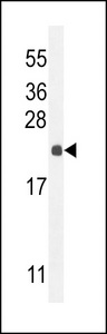 LOC729020 Antibody - hCG_2024410 Antibody (C-term) western blot analysis in mouse liver tissue lysates (35ug/lane).This demonstrates the CG antibody detected the CG protein (arrow).