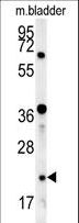 LOH12CR1 Antibody - LOH12CR1 Antibody western blot of mouse bladder tissue lysates (15 ug/lane). The LOH12CR1 antibody detected LOH12CR1 protein (arrow).