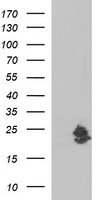 LOH12CR1 Antibody - HEK293T cells were transfected with the pCMV6-ENTRY control (Left lane) or pCMV6-ENTRY LOH12CR1 (Right lane) cDNA for 48 hrs and lysed. Equivalent amounts of cell lysates (5 ug per lane) were separated by SDS-PAGE and immunoblotted with anti-LOH12CR1.
