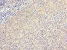 LOH12CR1 Antibody - Immunohistochemistry of paraffin-embedded human tonsil tissue using antibody at dilution of 1:100.