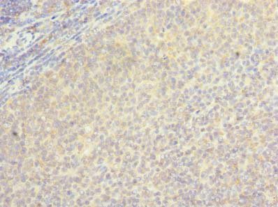 LOH12CR1 Antibody - Immunohistochemistry of paraffin-embedded human tonsil tissue using BORCS5 Antibody at dilution of 1:100
