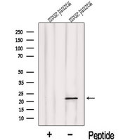 LOH12CR1 Antibody - Western blot analysis of extracts of mouse pancreas tissue using LOH12CR1 antibody. The lane on the left was treated with blocking peptide.