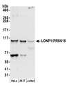 LONP1 / LON Antibody - Detection of human LONP1/PRSS15 by western blot. Samples: Whole cell lysate (50 µg) from HeLa, HEK293T, and Jurkat cells prepared using NETN lysis buffer. Antibody: Affinity purified rabbit anti-LONP1/PRSS15 antibody used for WB at 0.1 µg/ml. Detection: Chemiluminescence with an exposure time of 30 seconds.