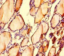 LONP1 / LON Antibody - Immunohistochemistry of paraffin-embedded human thyroid tissue at dilution of 1:100