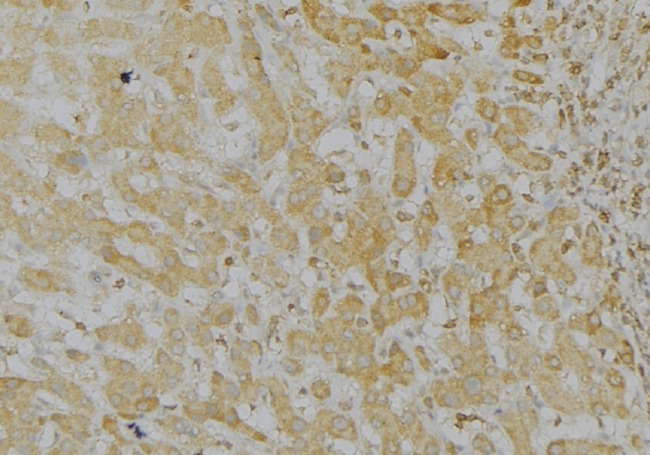 LONP1 / LON Antibody - 1:100 staining mouse liver tissue by IHC-P. The sample was formaldehyde fixed and a heat mediated antigen retrieval step in citrate buffer was performed. The sample was then blocked and incubated with the antibody for 1.5 hours at 22°C. An HRP conjugated goat anti-rabbit antibody was used as the secondary.