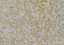 LONP1 / LON Antibody - 1:100 staining mouse liver tissue by IHC-P. The sample was formaldehyde fixed and a heat mediated antigen retrieval step in citrate buffer was performed. The sample was then blocked and incubated with the antibody for 1.5 hours at 22°C. An HRP conjugated goat anti-rabbit antibody was used as the secondary.
