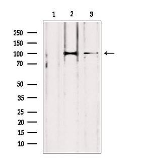 LONP1 / LON Antibody - Western blot analysis of extracts of various samples using LONP1 antibody. Lane 1: HeLa treated with blocking peptide. Lane 2: HeLa; Lane 3: mouse Myeloma cells;
