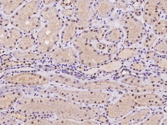 LONP2 / LONP Antibody - Immunochemical staining of human LONP2 in human kidney with rabbit polyclonal antibody at 1:500 dilution, formalin-fixed paraffin embedded sections.