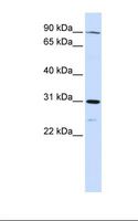 LONRF3 Antibody - Fetal liver lysate. Antibody concentration: 1.0 ug/ml. Gel concentration: 12%.  This image was taken for the unconjugated form of this product. Other forms have not been tested.