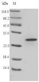 LYZ / Lysozyme Protein - (Tris-Glycine gel) Discontinuous SDS-PAGE (reduced) with 5% enrichment gel and 15% separation gel.