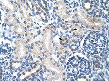Loricrin Antibody - LOR / Loricrin antibody ARP41738_T100-NP_000418-LOR(loricrin) Antibody was used in IHC to stain formalin-fixed, paraffin-embedded human kidney.  This image was taken for the unconjugated form of this product. Other forms have not been tested.