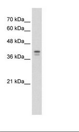 Loricrin Antibody - HepG2 Cell Lysate.  This image was taken for the unconjugated form of this product. Other forms have not been tested.