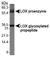 LOX / Lysyl Oxidase Antibody - LOX propeptide Antibody - Western blot of LOX propeptide on MDA-MB-231.  This image was taken for the unconjugated form of this product. Other forms have not been tested.