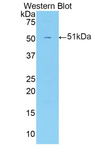 LOX / Lysyl Oxidase Antibody - Western blot of recombinant Lysyl Oxidase / LOX.  This image was taken for the unconjugated form of this product. Other forms have not been tested.