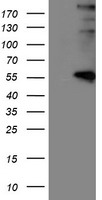 LOX / Lysyl Oxidase Antibody - HEK293T cells were transfected with the pCMV6-ENTRY control (Left lane) or pCMV6-ENTRY LOX (Right lane) cDNA for 48 hrs and lysed. Equivalent amounts of cell lysates (5 ug per lane) were separated by SDS-PAGE and immunoblotted with anti-LOX.
