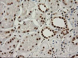 LOX / Lysyl Oxidase Antibody - IHC of paraffin-embedded Human Kidney tissue using anti-LOX mouse monoclonal antibody.