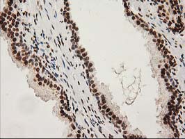 LOX / Lysyl Oxidase Antibody - IHC of paraffin-embedded Human prostate tissue using anti-LOX mouse monoclonal antibody.