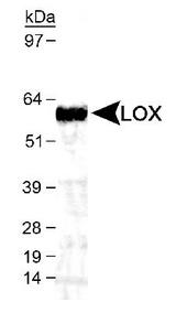 LOX / Lysyl Oxidase Antibody - Detection of LOX in mouse kidney lysate using antibody at 1:1000. ECL detection was 15 sec.  This image was taken for the unconjugated form of this product. Other forms have not been tested.