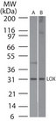 LOX / Lysyl Oxidase Antibody - Western blot of LOX in A) human skin and B) mouse ear skin lysate using Polyclonal Antibody to Lysyl Oxidase (LOX) at 1:500. Goat anti-rabbit Ig HRP secondary antibody, and PicoTect ECL substrate solution, were used for this test.