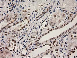 LOX / Lysyl Oxidase Antibody - IHC of paraffin-embedded Human Kidney tissue using anti-LOX mouse monoclonal antibody.