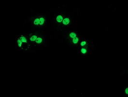 LOX / Lysyl Oxidase Antibody - Anti-LOX mouse monoclonal antibody immunofluorescent staining of COS7 cells transiently transfected by pCMV6-ENTRY LOX.
