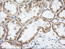 LOX / Lysyl Oxidase Antibody - Immunohistochemical staining of paraffin-embedded Human Kidney tissue using anti-LOX mouse monoclonal antibody. (Dilution 1:50).