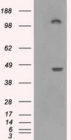 LOX / Lysyl Oxidase Antibody - HEK293T cells were transfected with the pCMV6-ENTRY control (Left lane) or pCMV6-ENTRY LOX (Right lane) cDNA for 48 hrs and lysed. Equivalent amounts of cell lysates (5 ug per lane) were separated by SDS-PAGE and immunoblotted with anti-LOX.
