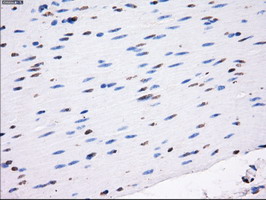 LOX / Lysyl Oxidase Antibody - Anti-LOX mouse monoclonal antibody  immunofluorescent staining of COS7 cells transiently transfected by pCMV6-ENTRY LOX.