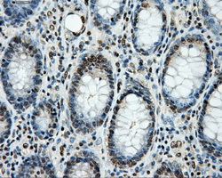 LOX / Lysyl Oxidase Antibody - Immunohistochemical staining of paraffin-embedded colon tissue using anti-LOX mouse monoclonal antibody. (Dilution 1:50).