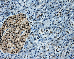 LOX / Lysyl Oxidase Antibody - Immunohistochemical staining of paraffin-embedded pancreas tissue using anti-LOX mouse monoclonal antibody. (Dilution 1:50).