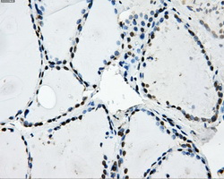 LOX / Lysyl Oxidase Antibody - Immunohistochemical staining of paraffin-embedded thyroid tissue using anti-LOX mouse monoclonal antibody. (Dilution 1:50).