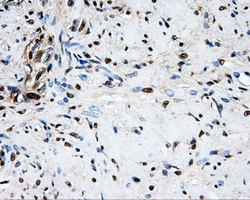 LOX / Lysyl Oxidase Antibody - Immunohistochemical staining of paraffin-embedded prostate tissue using anti-LOX mouse monoclonal antibody. (Dilution 1:50).