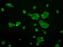 LOX / Lysyl Oxidase Antibody - Immunofluorescent staining of HepG2 cells using anti-LOX mouse monoclonal antibody.