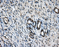 LOX / Lysyl Oxidase Antibody - IHC of paraffin-embedded Ovary tissue using anti-LOX mouse monoclonal antibody. (Dilution 1:50).