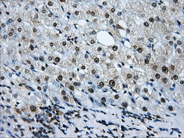 LOX / Lysyl Oxidase Antibody - IHC of paraffin-embedded liver tissue using anti-LOX mouse monoclonal antibody. (Dilution 1:50).
