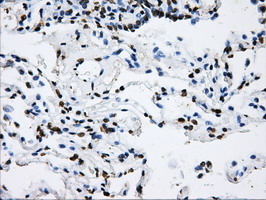 LOX / Lysyl Oxidase Antibody - IHC of paraffin-embedded lung tissue using anti-LOX mouse monoclonal antibody. (Dilution 1:50).