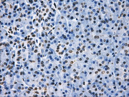 LOX / Lysyl Oxidase Antibody - IHC of paraffin-embedded pancreas tissue using anti-LOX mouse monoclonal antibody. (Dilution 1:50).