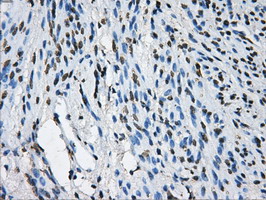 LOX / Lysyl Oxidase Antibody - IHC of paraffin-embedded endometrium tissue using anti-LOX mouse monoclonal antibody. (Dilution 1:50).