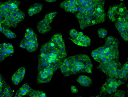 LOX / Lysyl Oxidase Antibody - Immunofluorescent staining of HepG2 cells using anti-LOX mouse monoclonal antibody.