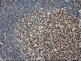 LOX / Lysyl Oxidase Antibody - IHC of paraffin-embedded Human lymph node tissue using anti-LOX mouse monoclonal antibody.